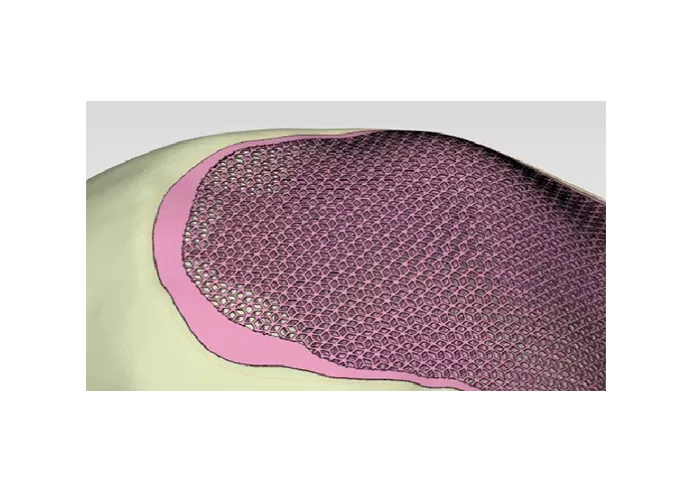 Программный продукт Materialise Mimics Innovation Suite (MIS) №3