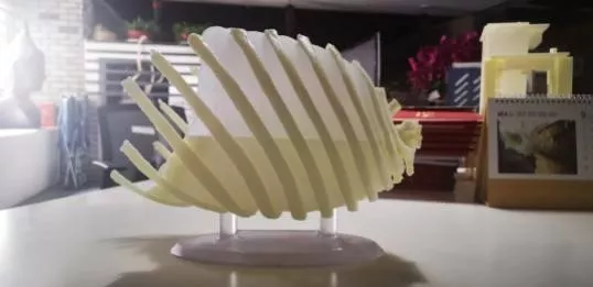 Создание анатомической 3D‑модели органов пациента по технологии SLA