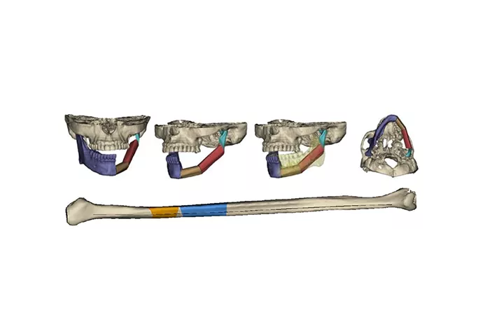 Программный продукт Materialise Mimics Innovation Suite (MIS) №5