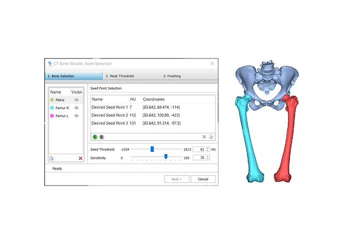 Программный продукт Materialise Mimics Innovation Suite (MIS) №1