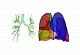 Программный продукт Materialise Mimics Innovation Suite (MIS)